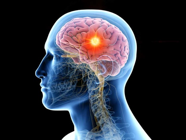 head scan illustration